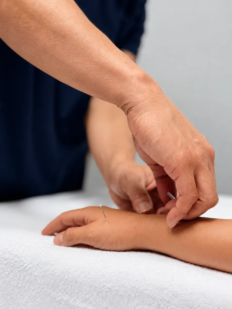 Dry Needling at Adams Chiropractic, Plano TX